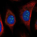 URB2 Polyclonal Antibody