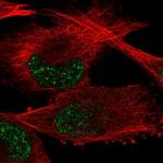 GTF2H2 Polyclonal Antibody