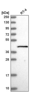 GTF2H2 Antibody in Western Blot (WB)