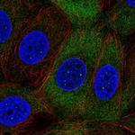 NUP210L Polyclonal Antibody