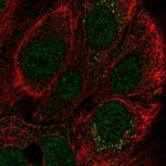 CCDC144A Polyclonal Antibody