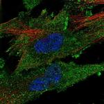 CLIC2 Polyclonal Antibody