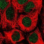 SLC17A9 Antibody in Immunocytochemistry (ICC/IF)