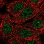 NXT1 Antibody in Immunocytochemistry (ICC/IF)