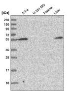CHST3 Antibody in Western Blot (WB)