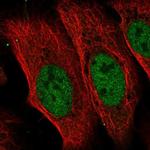 CDADC1 Antibody in Immunocytochemistry (ICC/IF)
