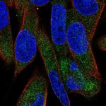 UGT3A1 Polyclonal Antibody