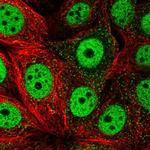 TOB1 Polyclonal Antibody