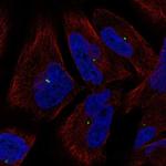 KIAA0101 Polyclonal Antibody