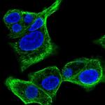 SPTLC3 Polyclonal Antibody