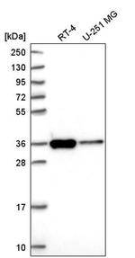 SFXN3 Antibody in Western Blot (WB)