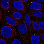 WDR72 Polyclonal Antibody