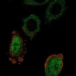 MOSPD3 Polyclonal Antibody