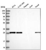 MOSPD3 Antibody in Western Blot (WB)