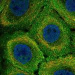 MR1 Polyclonal Antibody