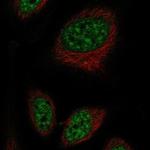 RFPL2 Polyclonal Antibody