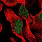 PTBP3 Polyclonal Antibody