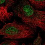 THOC5 Polyclonal Antibody