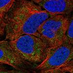 AGPAT1 Polyclonal Antibody