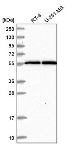 MSL2 Antibody in Western Blot (WB)