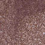 CCAR1 Polyclonal Antibody