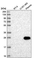 HSF4 Antibody in Western Blot (WB)