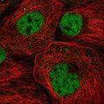 ZNF317 Polyclonal Antibody