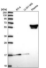 ZNF317 Antibody in Western Blot (WB)