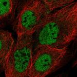 BRCC3 Polyclonal Antibody