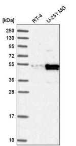 PDLIM7 Antibody in Western Blot (WB)