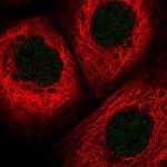 HLTF Polyclonal Antibody