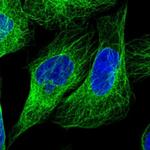 LARP6 Antibody in Immunocytochemistry (ICC/IF)