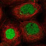 ITCH Polyclonal Antibody