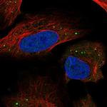 HSD11B1L Polyclonal Antibody