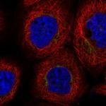 DYM Polyclonal Antibody