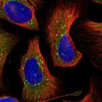 DNAJC21 Polyclonal Antibody