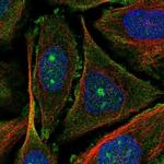 UTP20 Polyclonal Antibody