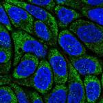 Viperin Polyclonal Antibody