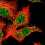 BTBD12 Polyclonal Antibody