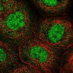 ANKRD11 Polyclonal Antibody