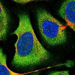 eIF2b alpha Polyclonal Antibody