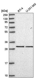 eIF2b alpha Antibody in Western Blot (WB)