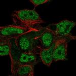 CSPG5 Antibody in Immunocytochemistry (ICC/IF)