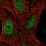 ZNF296 Polyclonal Antibody