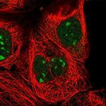 ZXDC Polyclonal Antibody