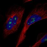 GLTSCR2 Polyclonal Antibody