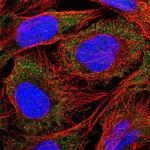 SLC18B1 Polyclonal Antibody