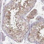 ERGIC2 Antibody in Immunohistochemistry (IHC)