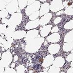 KRT81 Polyclonal Antibody