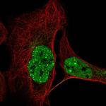 CCDC188 Polyclonal Antibody